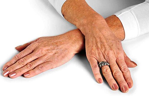 Δέρμα χεριών με αλλαγές που σχετίζονται με την ηλικία που απαιτούν τη χρήση τεχνικών αναζωογόνησης